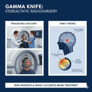 Gamma Knife
