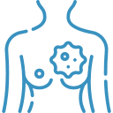 Breast Cancers doctor in jaipur