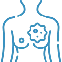 Breast Cancers doctor in jaipur