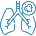 Lung Cancers doctor in jaipur