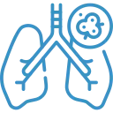 Lung Cancers doctor in jaipur